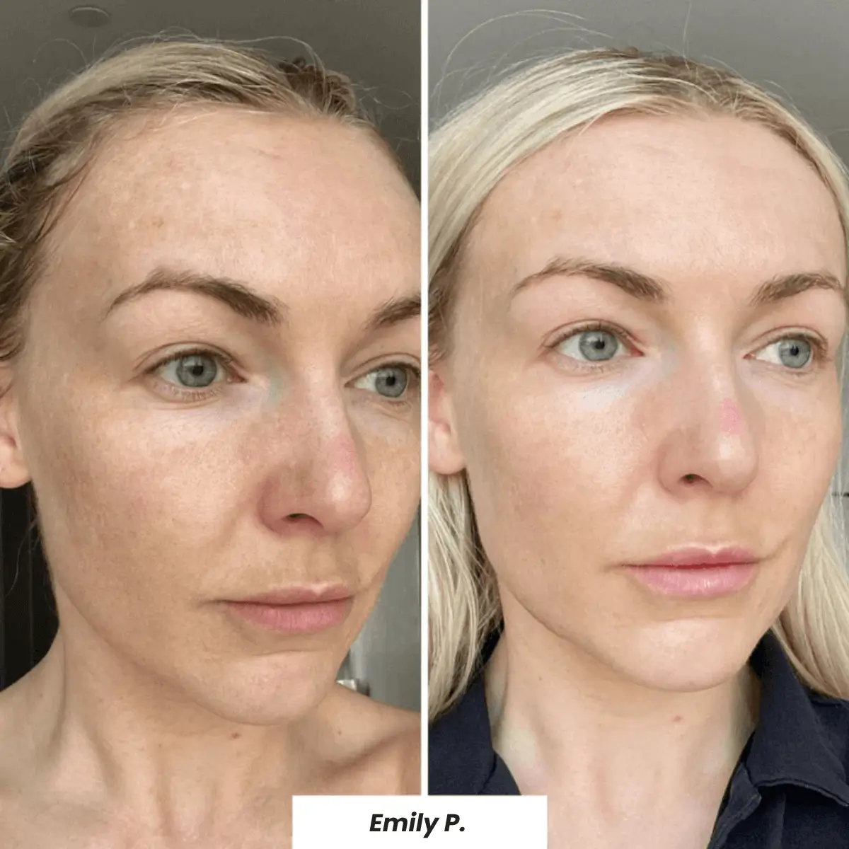 🔥 Buy 2 Collagen Night Masks, Get 1 Free! 🔥 Wake Up to Youthful, Hydrated Skin – Limited Time Offer! 💖