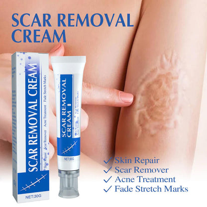 Viralaluna Scar Cream – Clear Skin Boost 🌸