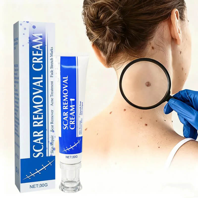 Viralaluna Scar Cream – Clear Skin Boost 🌸