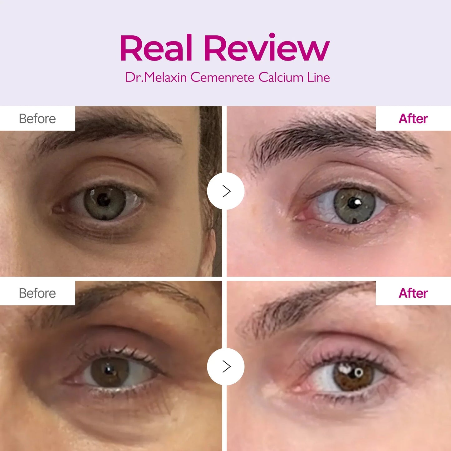 ✨ LAST DAY BUY 1 GET 1 FREE✨Cemenrete Calcium Dark Spot Eye Cream | Dark Circle, Anti-aging, Sagging, Elasticity