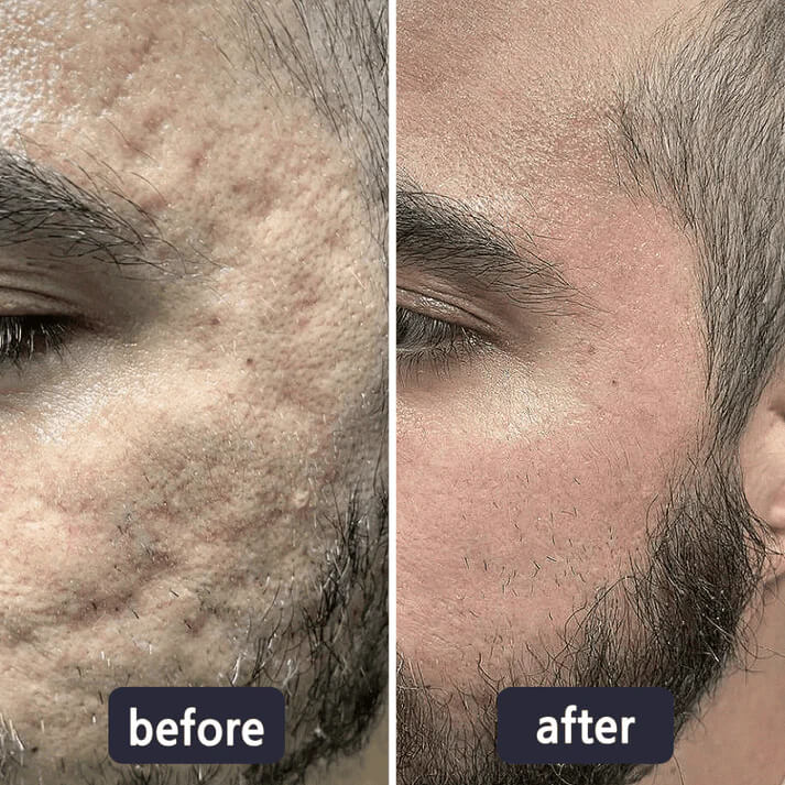 Viralaluna Scar Cream – Clear Skin Boost 🌸