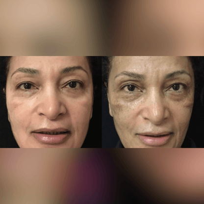 Luxevéria | Erase 98% of Wrinkles & Look 15 Years Younger in Just 7 Days!