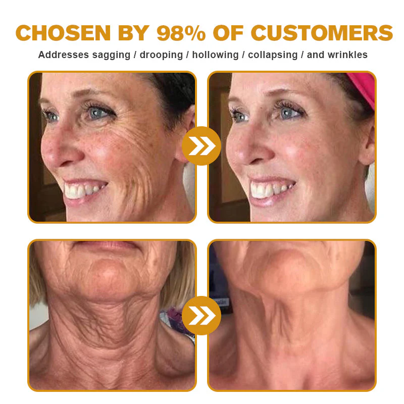👨‍⚕️ Made and Shipped from US✅  Botox Bee Venom Wrinkle Removal Cream- LAST DAY 80% OFF