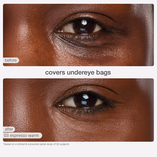 🔥 Buy 1 Get 1 FREE! Instant Cover Duo | Blur Concealer Stick & Brush ✨