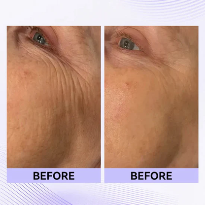 ⚡ 60-Second Instant Eye Tightener – Easy-Wear Technology for Lifted, Smooth Eyes