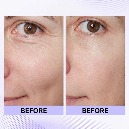 ⚡ 60-Second Instant Eye Tightener – Easy-Wear Technology for Lifted, Smooth Eyes