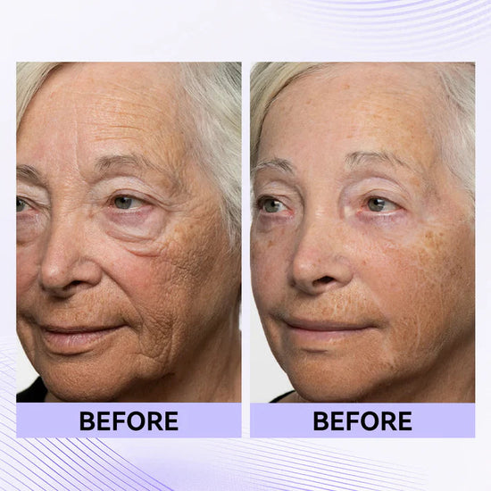 ⚡ 60-Second Instant Eye Tightener – Easy-Wear Technology for Lifted, Smooth Eyes