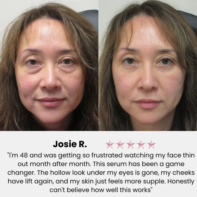 Korean Collagen Boosting Anti-Wrinkle Serum – Volufiline, Elasticity & Glass Skin Hydration