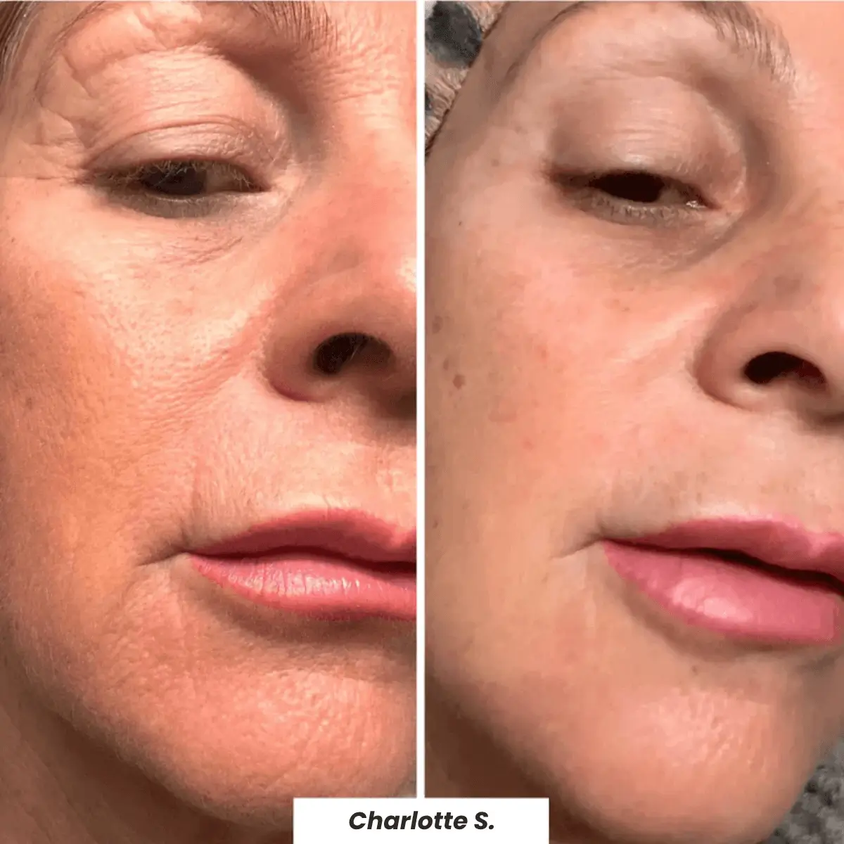🔥 Buy 2 Collagen Night Masks, Get 1 Free! 🔥 Wake Up to Youthful, Hydrated Skin – Limited Time Offer! 💖