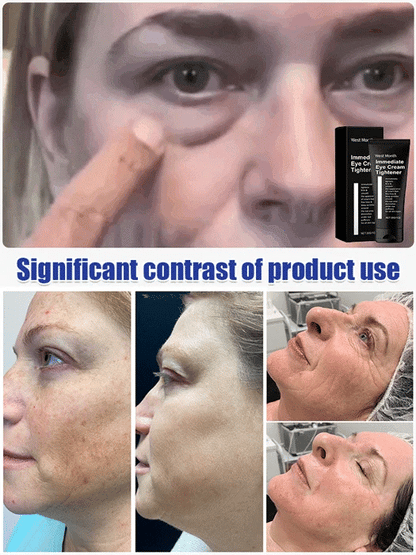 ⭐️ BUY 1 GET 1 FREE ⭐️ Firming and Moisturizing Eye Cream 📢 SAVE UP TO 67% 📢