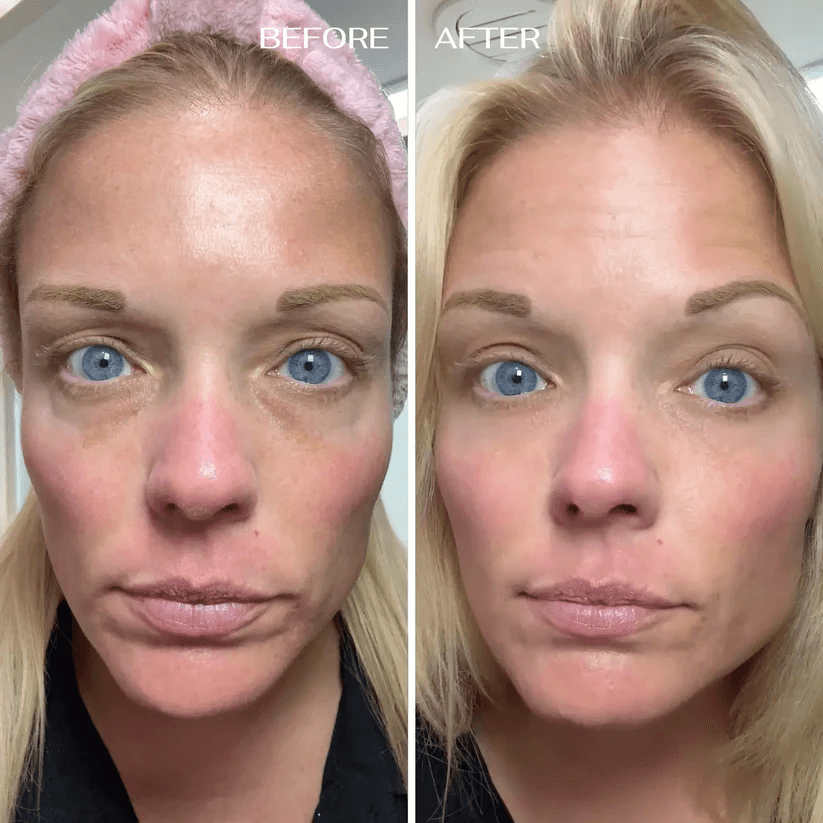 💥 Under-Eye Renewal Balm — Black Friday Special: 50% OFF!