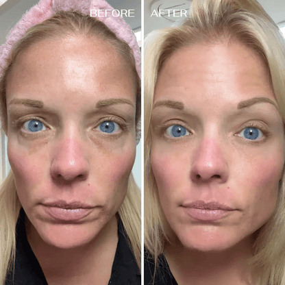 💥 Under-Eye Renewal Balm — Black Friday Special: 50% OFF!