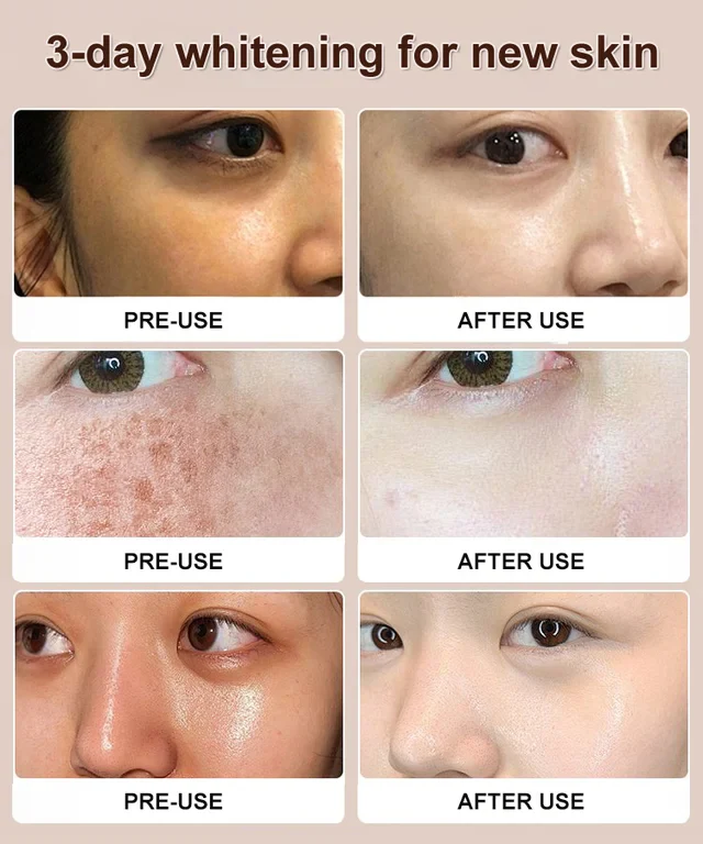 [Anti-Wrinkle and Yellowing Reduction] Professional Facial Anti-Wrinkle Cream