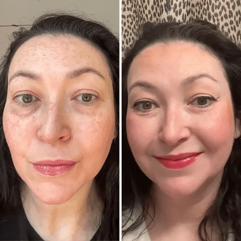💥 Under-Eye Renewal Balm — Black Friday Special: 50% OFF!