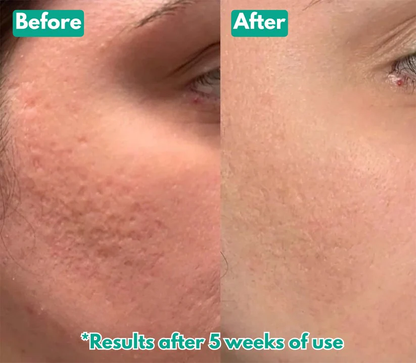 🏆Flash Sale⚡ Microcrysta  Serum PM Duo