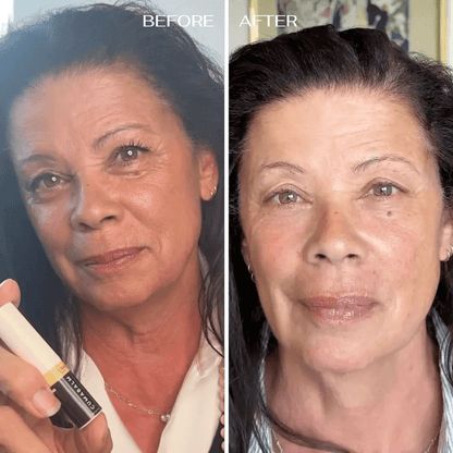 💥 Under-Eye Renewal Balm — Black Friday Special: 50% OFF!