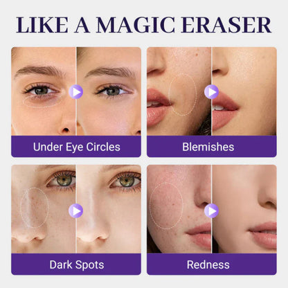 💜LAST DAY - BUY 1 GET 1 FREE💜Matte Concealer for Face & Body