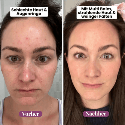 🏆Hot Sale⚡Anti-Aging Multi-Balm Stick - Wrinkle Care for Face, Lips & Eyes