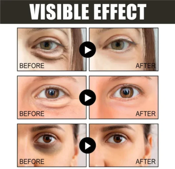 ✨ New Retinol + Caffeine Anti-Wrinkle Stay-Up-Late Eye Cream 👀⚡