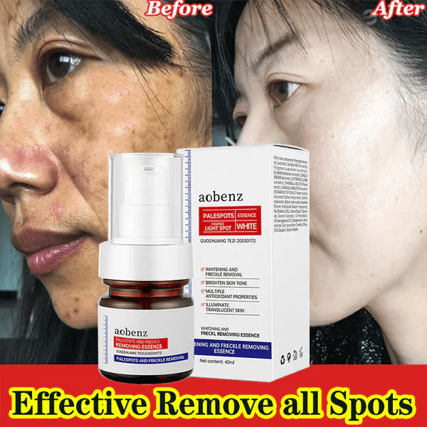 🔥Vitamin C Whitening Freckles Face Cream Remove Melasma Dark Spots Lighten Melanin