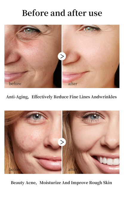 Anti-aging Face Cream