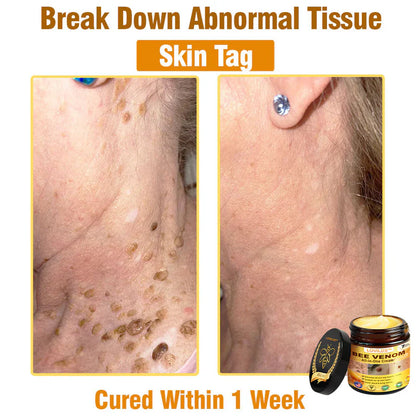LOVILDS™ Bee Venom All-in-One Cream US Dermatologist Approved