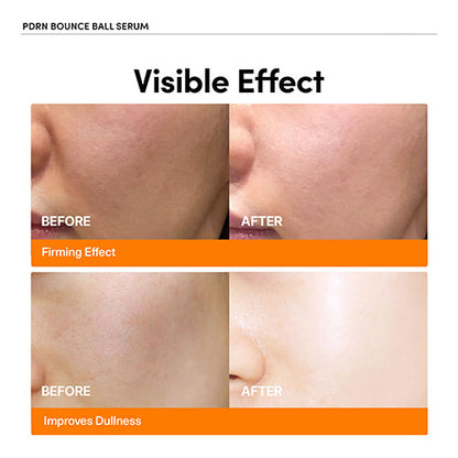 💥 Salmon DNA Bounce Serum – Lift, Repair & Restore Youthful Glow 🌟