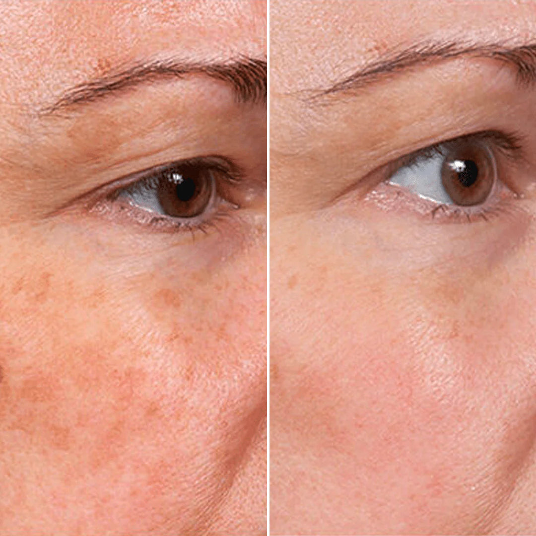 ✨ Buy 2, Get 1 Free! Rejuvenate Face Serum – Glow Instantly! 🌸