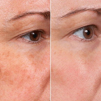 ✨ Buy 2, Get 1 Free! Rejuvenate Face Serum – Glow Instantly! 🌸