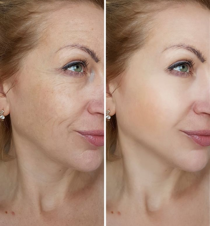 FerméLuxe | Firms sagging skin by 98% in 24 hours.